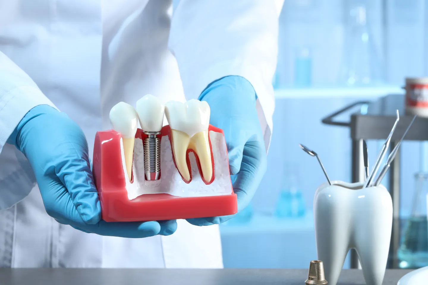 Dental Implant Candidate