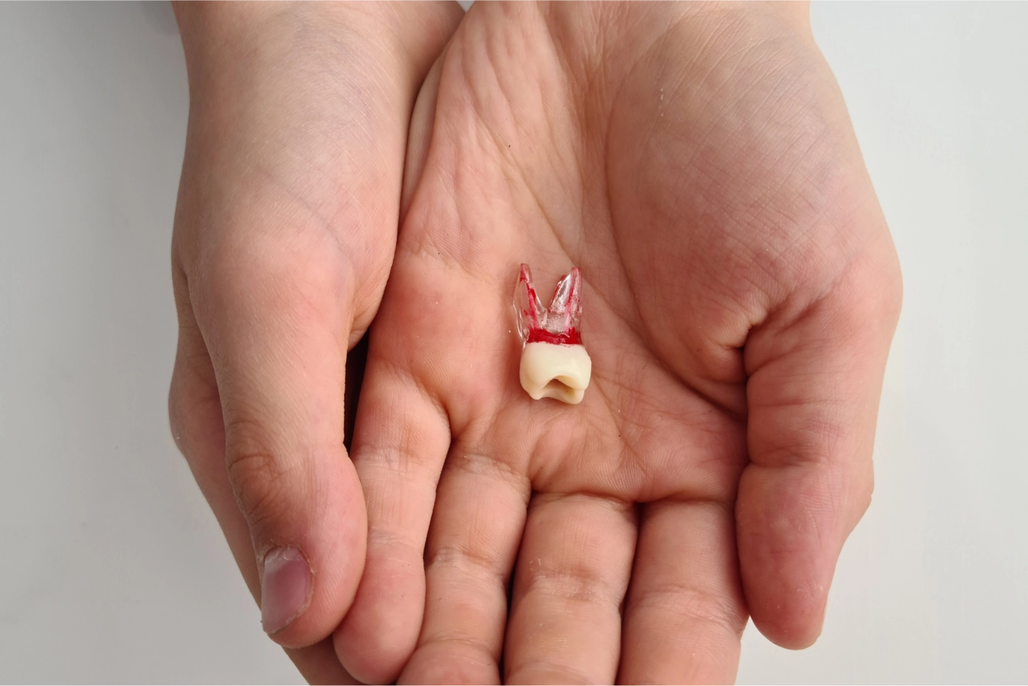 Dental Implants Consultation