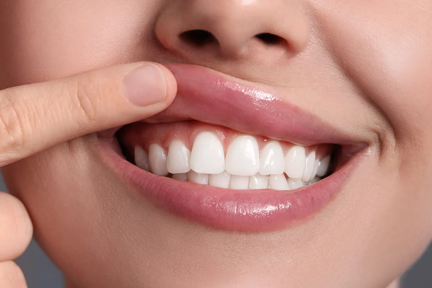 Gum Contouring