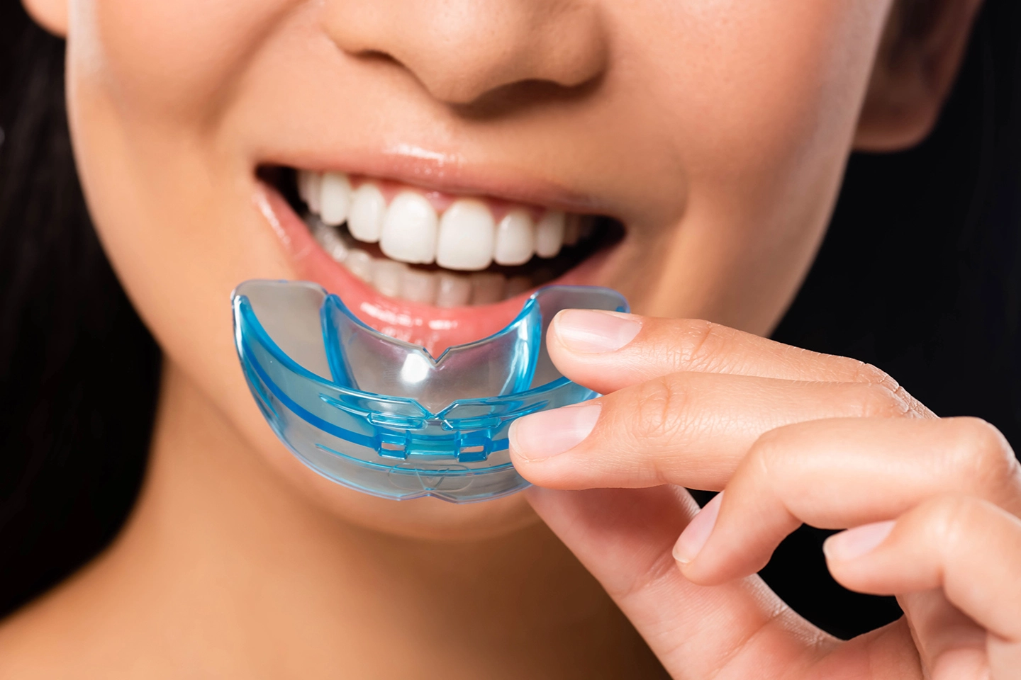 Mouthguards