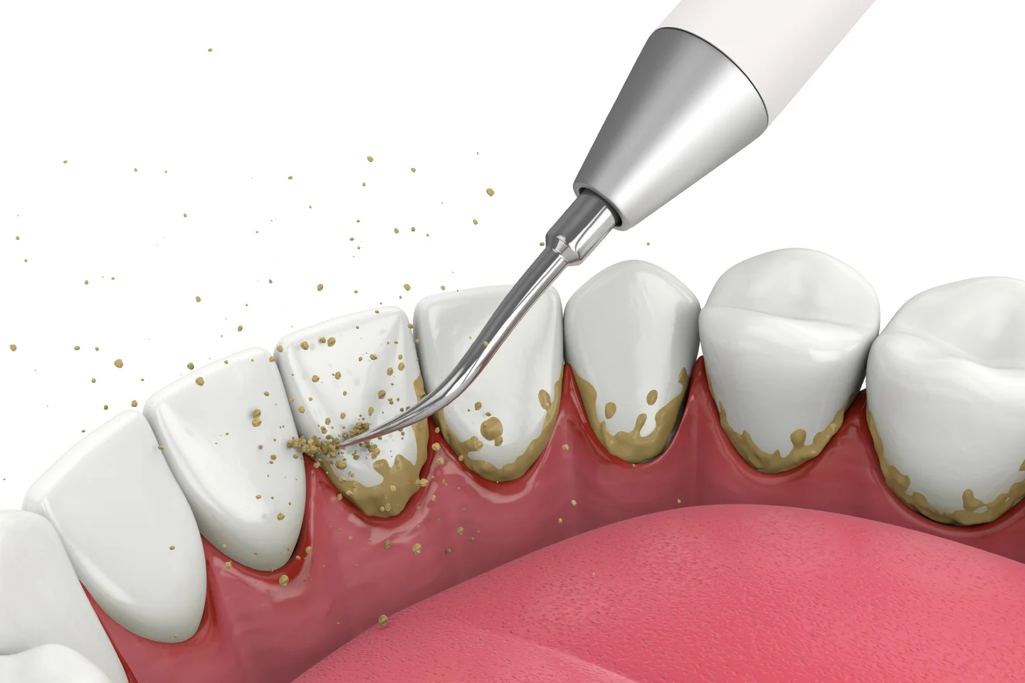 Routine Dental Procedures