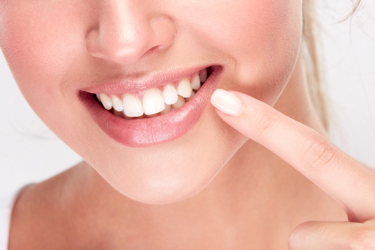 Smile Makeover