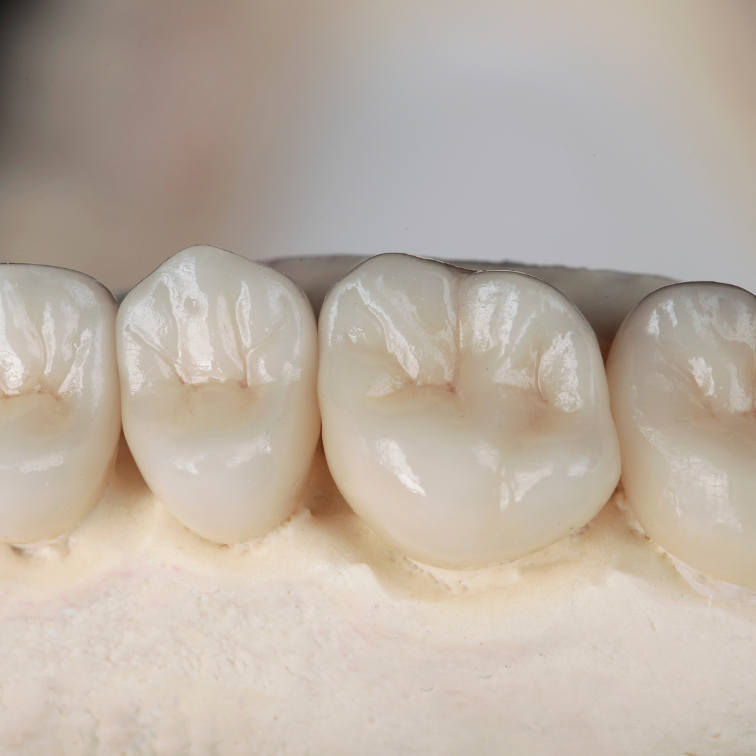 Dental Crowns