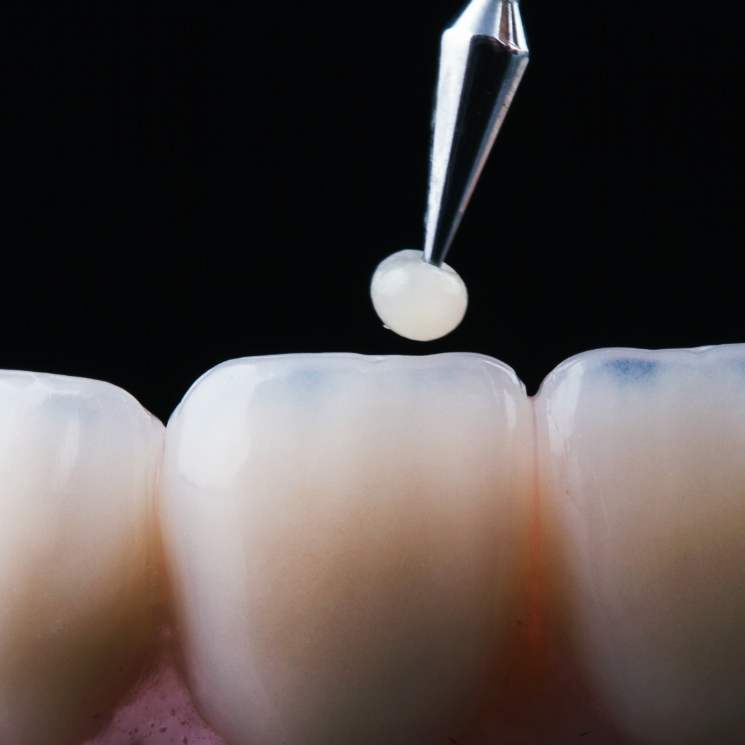 Restorative Dentistry